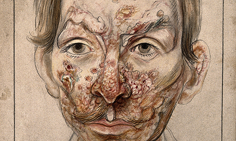 SyphFace 009