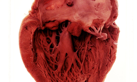 heart